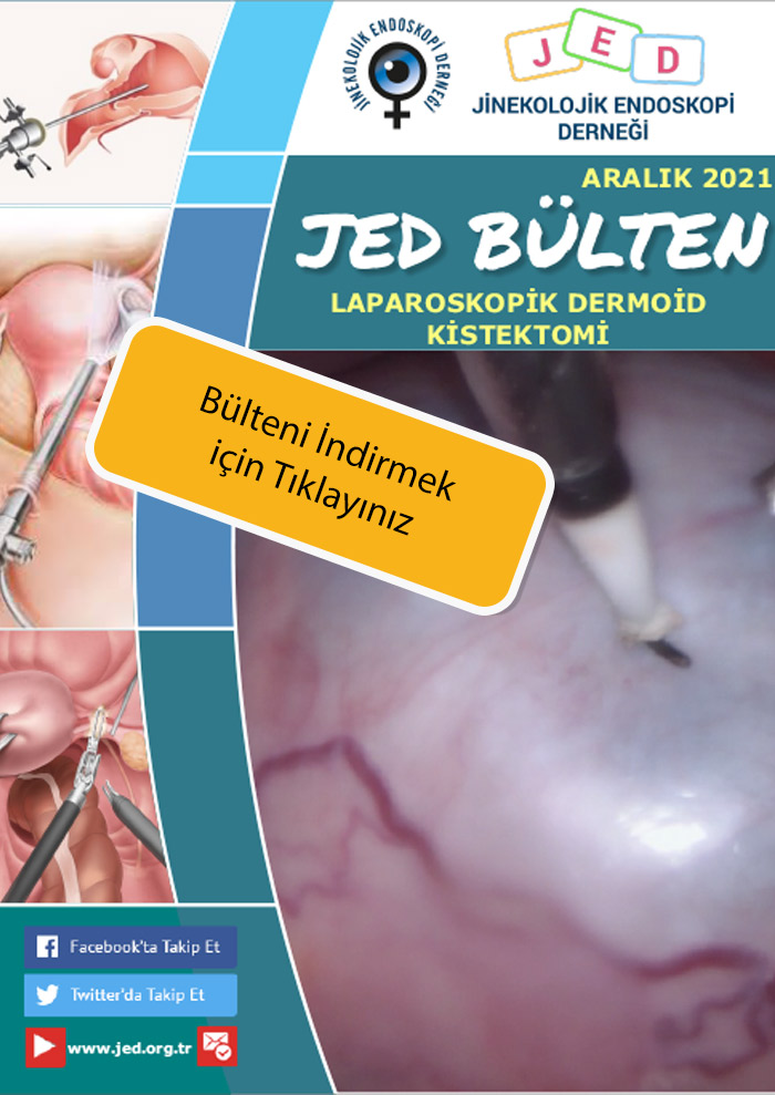 Bulten