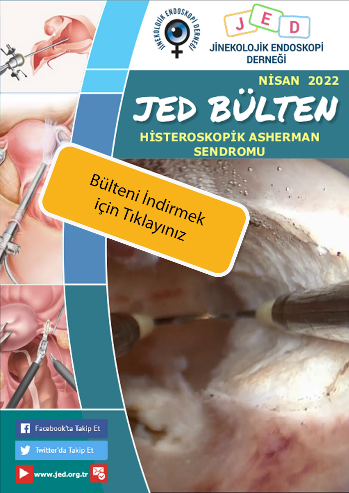 nisan2022bulten